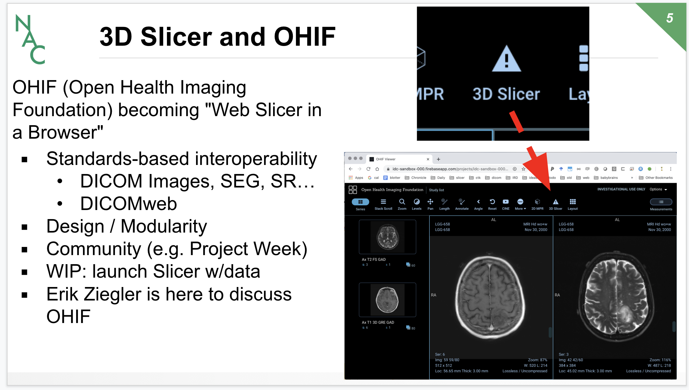 SlicerInOHIF